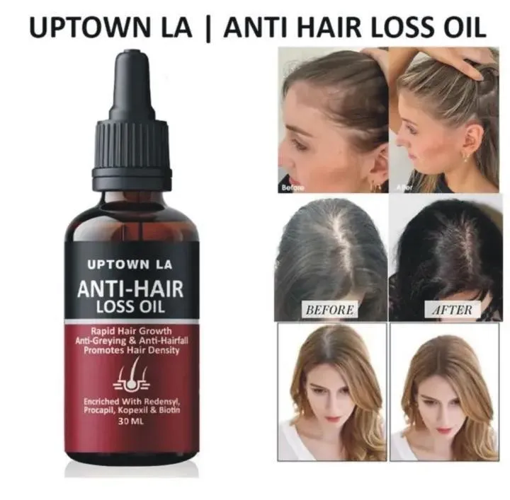 Anti-Hair Loss Oil for Women 30ml Hair Growth & Anti-Fall